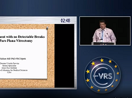 Management of Rhegmatogenous Retinal Detachment