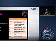 Management of Suprachoroidal Hemorrhage