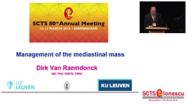 Management of the mediastinal mass