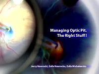 Managing Optic Pit - The Right Stuff Managing Optic Pit - The Right Stuff