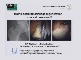 Régénération de la matrice du cartilage assistée - où en sommes-nous?