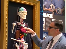 Mayo Clinic Minute: How 3D imaging helps doctors and patients