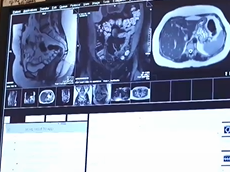 Mayo Clinic Minute: What's an MRI? And why do I need one?