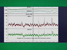 Measuring OPP with Continuous Radio Telemetry