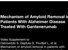 Mechanism of Amyloid Removal in Patients With Alzheimer Disease Treated With Gantenerumab Part 3 Mechanism of Amyloid Removal in Patients With Alzheimer Disease Treated With Gantenerumab Part 3