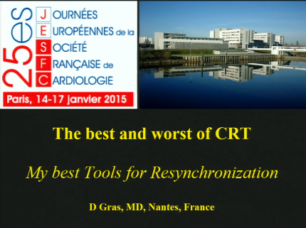 Mes meilleurs outils pour resynchroniser