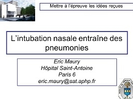 Mettre à l'épreuve les idées reçues - L'intubation nasale entraîne des pneumonies Mettre à l'épreuve les idées reçues - L'intubation nasale entraîne des pneumonies