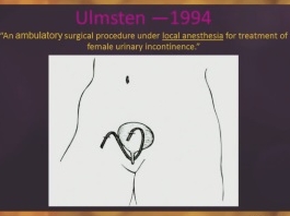 Bandelette mi-urétrale