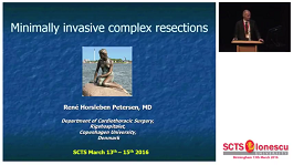 Minimally invasive complex lung resections