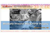 Minimally invasive mitral valve surgery Minimally invasive mitral valve surgery