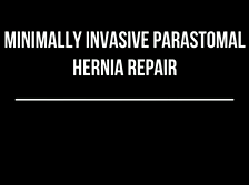 Minimally invasive parastomal hernia repair: laparoscopic vs. robot assisted. A video-vignette Minimally invasive parastomal hernia repair: laparoscopic vs. robot assisted. A video-vignette