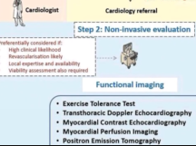 MINOCA Myocardial Infarction in Non obstructive coronary artery
