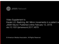 Mirror Movements Following Brain Tumor Resection Mirror Movements Following Brain Tumor Resection