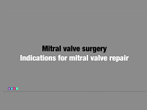 Mitral valve surgery - Indications for mitral valve repair