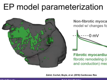 Modeling and Simulation of Cardiac Arrhythmia