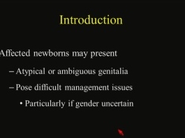 Gestion moderne du nouveau-né avec des troubles du développement sexuel
