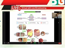Molecular Drivers of Minimal residual Disease in Ovarian Cancer