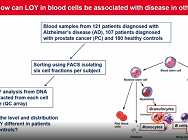 Mosaic loss of chromosome Y (LOY) in leukocytes: from discovery to impact