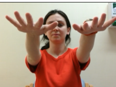 Movement Disorder Due to Action Myoclonus Renal Failure Syndrome (AMRFS) Movement Disorder Due to Action Myoclonus Renal Failure Syndrome (AMRFS)