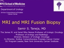 IRM et biopsie par fusion IRM