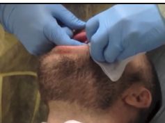 MRSA / Staph or Cellulitis? (Extended Cut) Cysts, Popping & Surgery!