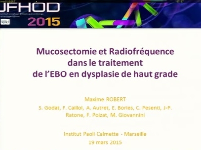 Mucosectomie et radiofréquence dans le traitement de l’EBO en dysplasie de haut grade Mucosectomie et radiofréquence dans le traitement de l’EBO en dysplasie de haut grade