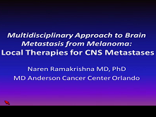 Multidisciplinary Approach to Brain Metastasis from Melanoma: The Emerging Role of Systemic Therapies 3 Multidisciplinary Approach to Brain Metastasis from Melanoma: The Emerging Role of Systemic Therapies 3