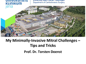 My minimally invasive mitral challenges - tips and tricks