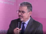 Myomes utérins : prise en charge multidisciplinaire