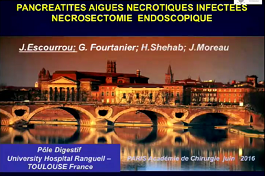 Nécrosectomie endoscopique au cours des pancréatites aigües nécrotiques infectées Nécrosectomie endoscopique au cours des pancréatites aigües nécrotiques infectées