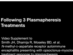 N-methyl-d-aspartate Receptor Autoimmune Encephalitis Presenting With Opsoclonus-Myoclonus: Treatmen-3 N-methyl-d-aspartate Receptor Autoimmune Encephalitis Presenting With Opsoclonus-Myoclonus: Treatmen-3