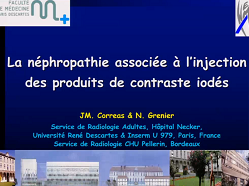 Néphropathie associée à l'injection des produits de contraste iodés Néphropathie associée à l'injection des produits de contraste iodés