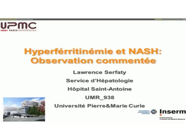NASH et hyperferritinémie (3)