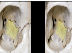 Navigating the Orbit - 3D TV