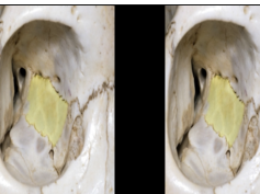 Navigating the Orbit - Anaglyph