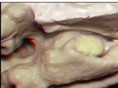 Navigating the Ventricles (3D)
