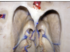 Navigating the Ventricles