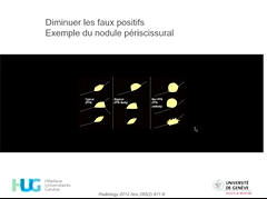 Nelson et le dépistage du cancer pulmonaire - Colloque de médecine des HUG, le 26 mai 2020