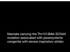 Neonatal Stridor Neonatal Stridor