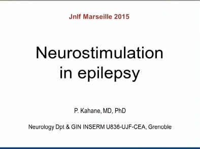 Neuromodulation dans les épilepsies pharmacorésistantes