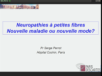 Neuropathie à petites fibres et fibromyalgie Neuropathie à petites fibres et fibromyalgie