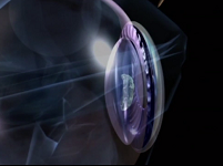 New Devices to Perform a Sized and Centered Capsulorhexis