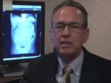 New Protocol for CT Colonography -- Mayo Clinic