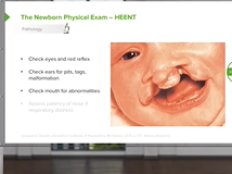 Newborn Physical Exam - Pediatrics