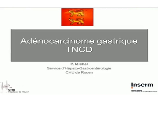 Nouveauté du Thésaurus National de Cancérologie Digestive (1)