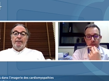 Nouveautés dans limagerie des cardiomyopathies : l'amylose cardiaque