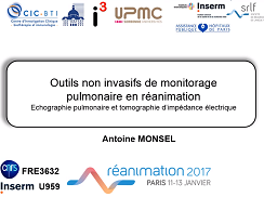 Nouvelles technologies en réanimation - Diagnostics non-invasifs (pulmovista, échographie) Nouvelles technologies en réanimation - Diagnostics non-invasifs (pulmovista, échographie)