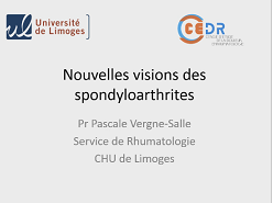 Nouvelles visions des spondyloarthrites
