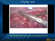 Novel surgical stapler, followup