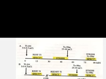 Nuclear Cardiology: understanding the basics
